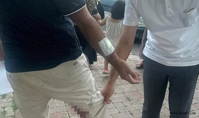 Şanlıurfa’da bir vatandaşı ısıran köpek kuduz çıktı