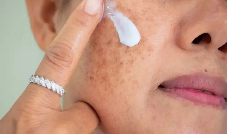 Dermatoloji uzmanından güneş ışınları uyarısı