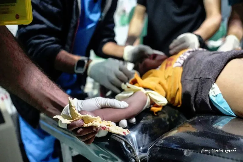 Gazze’de yürek burkan an: Yaralı çocuk hastaneye kanlı ekmeğiyle getirildi